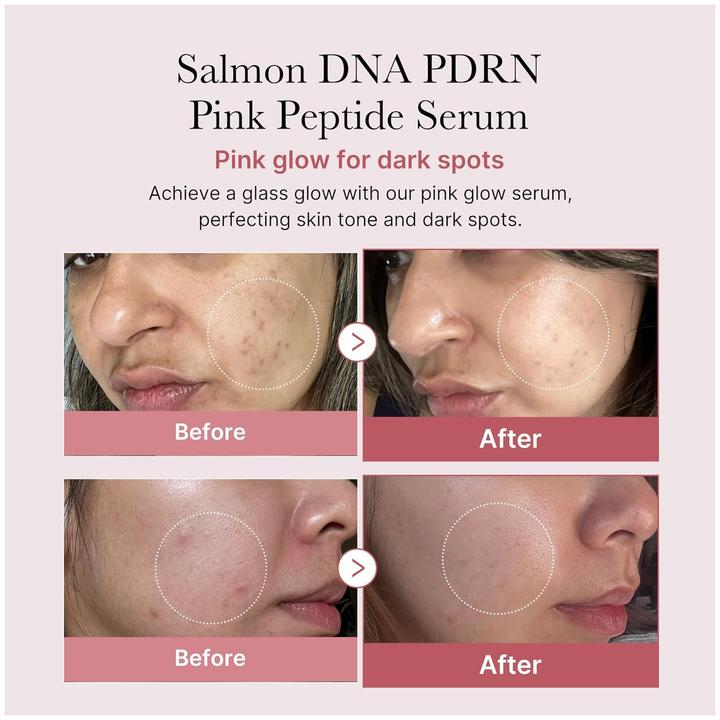 Immagine prodotto Medicube Peptide rosa PDRN (30 ml)