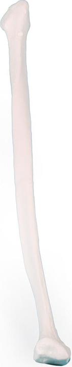 Produktbild Erler Zimmer Fibula (Wadenbein)