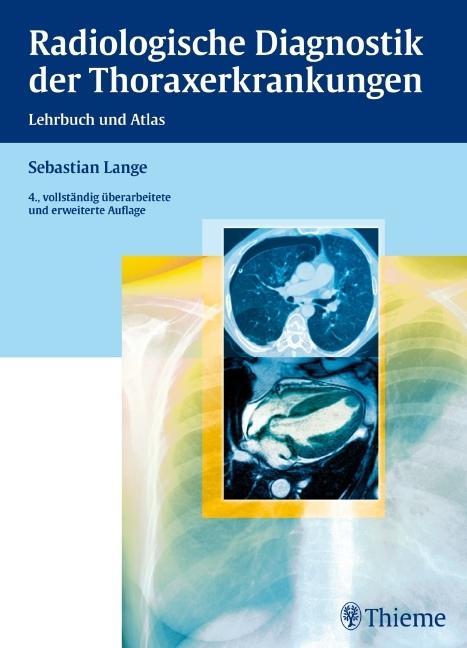 Produktbild Radiologische Diagnostik der Thoraxerkrankungen (Deutsch, Sebastian Lange, 2010)