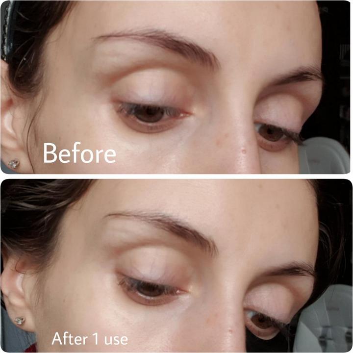 Immagine prodotto Benton Snail Bee Ultimate Hydrogel Eye Patch (Lembi)