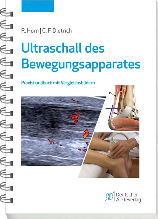 Actual product image Ultraschall des Bewegungsapparates (German, Rudolf Horn, Christoph F. Dietrich, 2022)