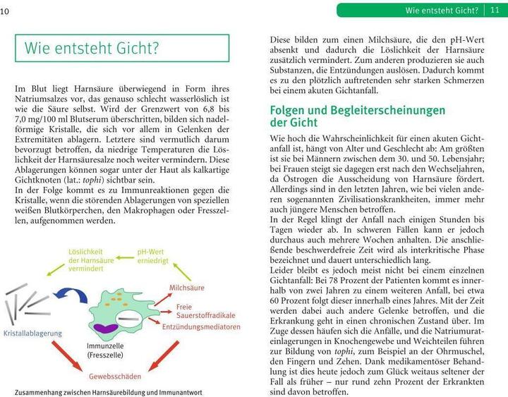Immagine prodotto Die richtige Ernährung bei Gicht (Tedesco, Ibrahim Elmadfa, 2017)