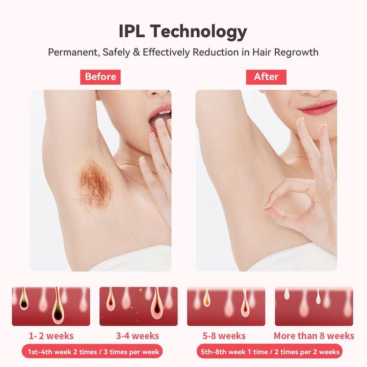 Produktbild Love Dock IPL Haarentfernungsgerät mit die Eis-Kühlfunktion