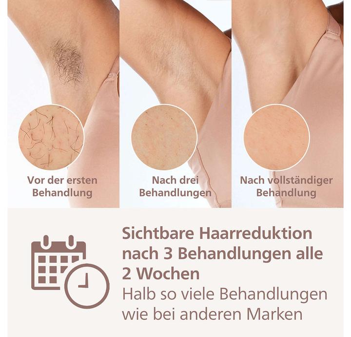 Produktbild Philips Lumea IPL Series 9000