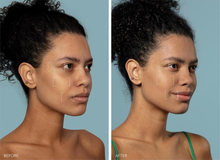 Actual product image Foreo Ufo 3 Mini