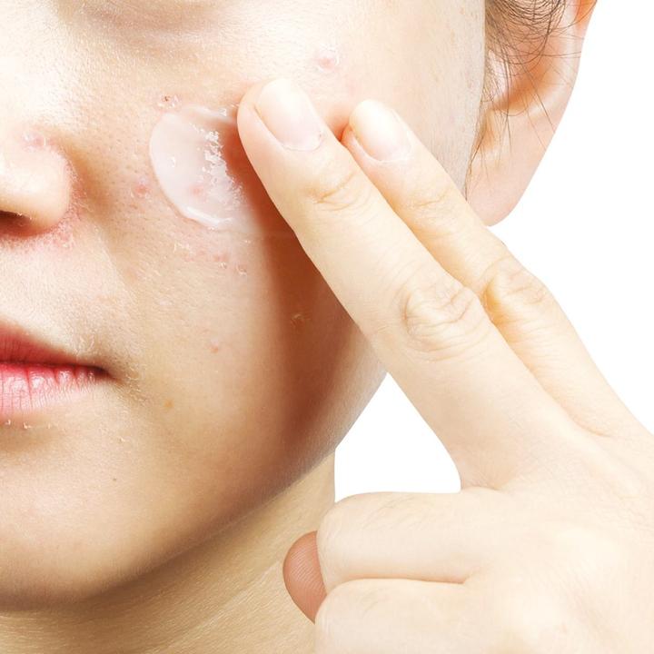 Produktbild Yadah Anti-T Moisturizing Cream (50 ml, 24h Creme)