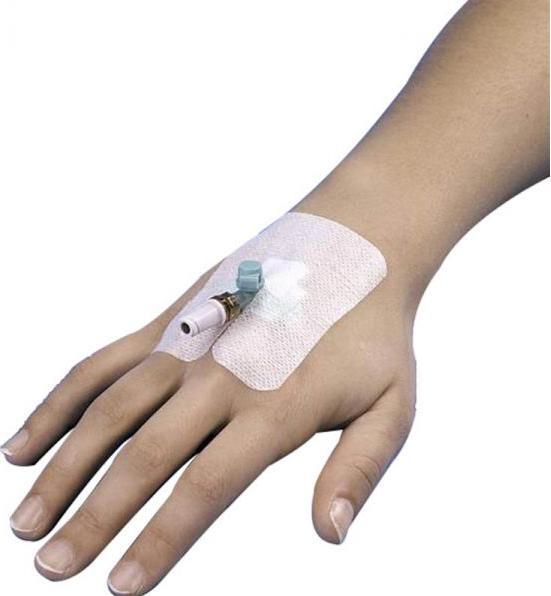 Actual product image 3M IV Cannula fixation 6x8cm sterile (50 pcs)