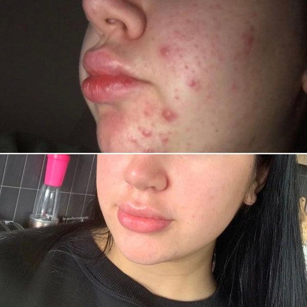 Immagine prodotto Eco by Sonya Super Acai Exfoliator - Peeling intensivo (Esfoliazione, 100 ml)