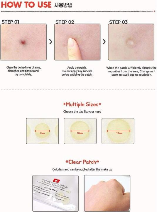 Produktbild Cosrx Acne Pimple Master