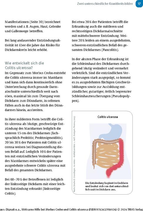 Produktbild Wirksame Hilfe bei Morbus Crohn und Colitis ulcerosa (Deutsch, Jürgen-Michael Stein, Axel Dignass, Franz Hartmann, 2024)