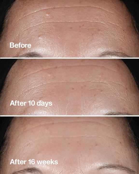 Produktbild Clinique Smart Custom-Repair Serum (50 ml)