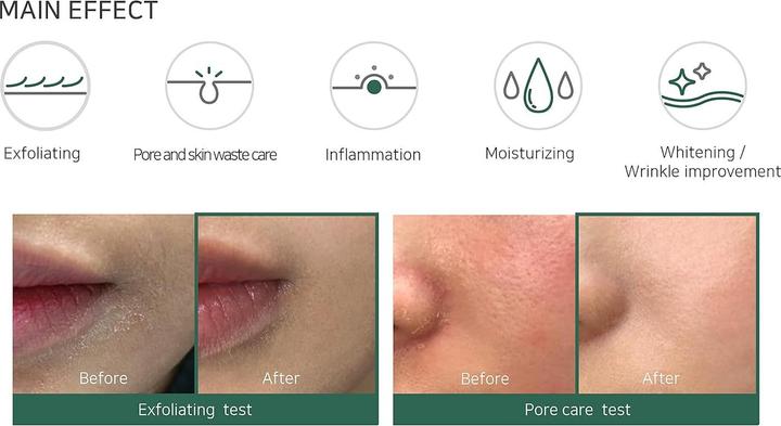 Immagine prodotto Some By Mi 30 giorni di miracolo (Acqua tonica, 150 ml)