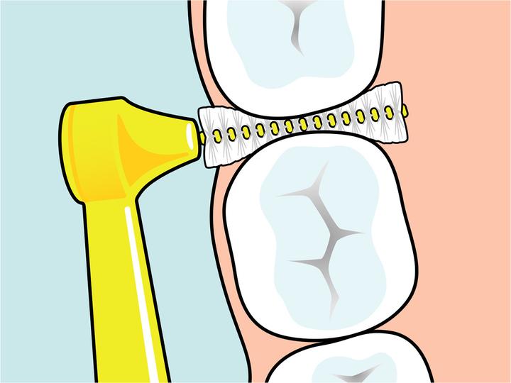 Produktbild TePe Interdentalbürsten Angle Mixed Pack ISO 0-5 (6 x, 0.80 mm)