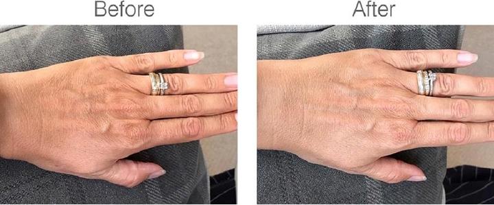 Actual product image Rio LED hand mask handLITE