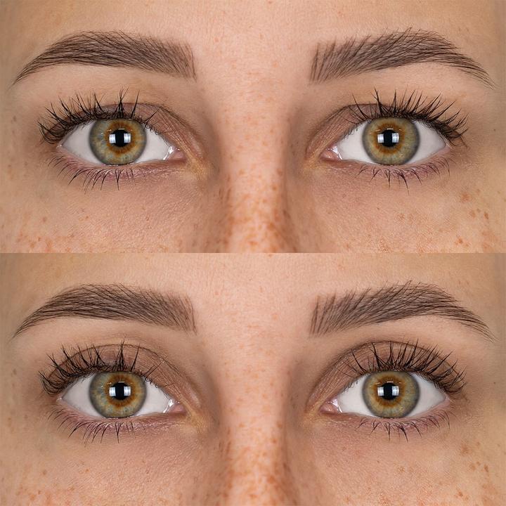 Actual product image Fleeky Magic Stripes stickers against drooping eyelids (size S)