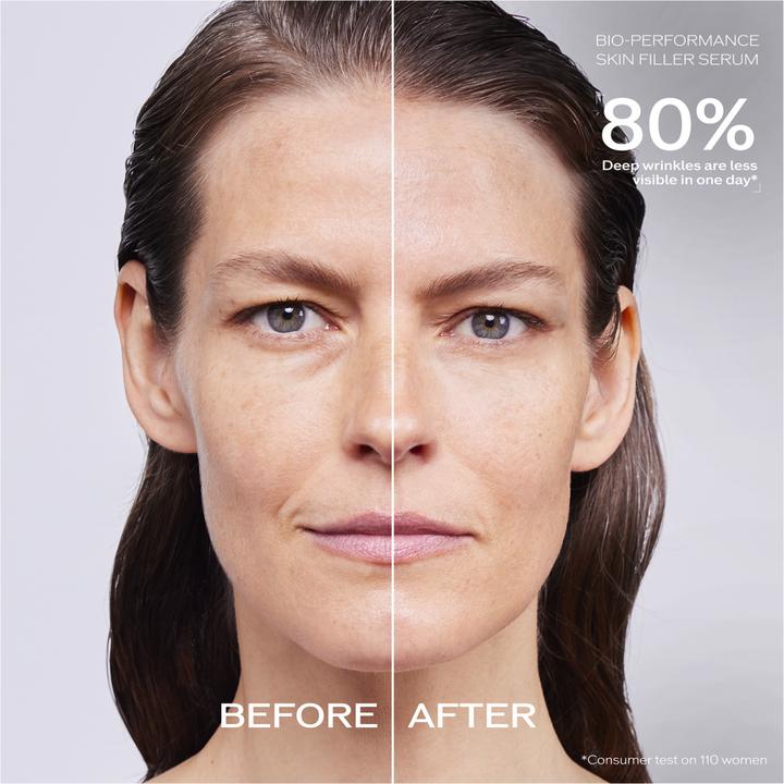 Image du produit Shiseido Recharge Skin Filler D & N (30 ml)