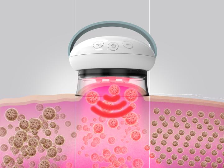 Image du produit Homedics Masseur Smoothee IR