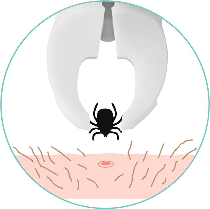 Image du produit TickSafe Zeckengreifer