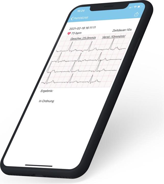 Actual product image Pulox PM10 Mobile ECG