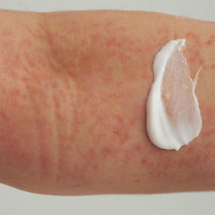 Immagine prodotto Dado Sens EXTRODERM Hautbalsam (Crema corpo, 25 ml)