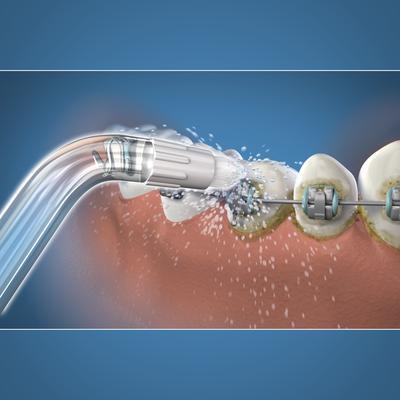 Actual product image Waterpik Orthodontic (Oral irrigator attachments)