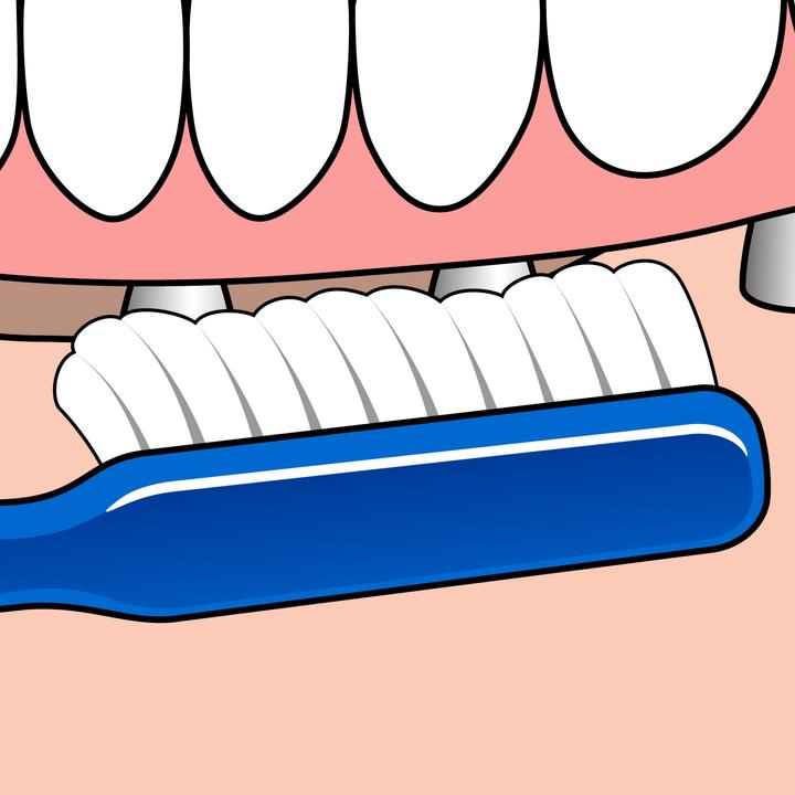 Immagine prodotto TePe Spazzola ortodontica per impianti (Medio, 1 x)