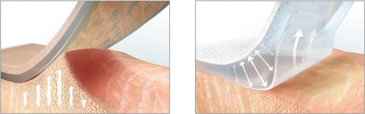 Image du produit Hansaplast Ultra Sensitive (10 x)