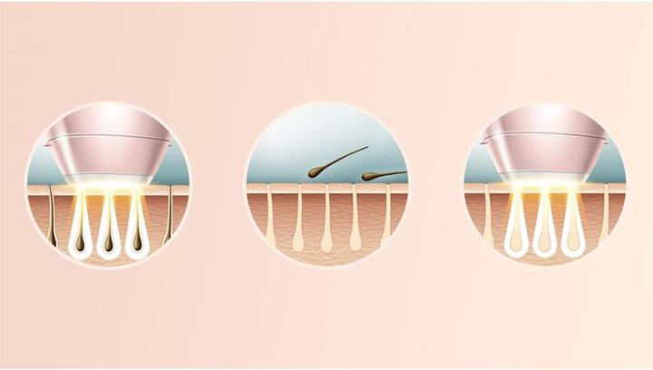 Actual product image Philips Lumea Prestige
