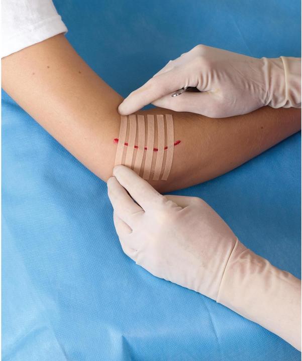 Actual product image Nexcare Steri-Strip wound closure strips (6 x)