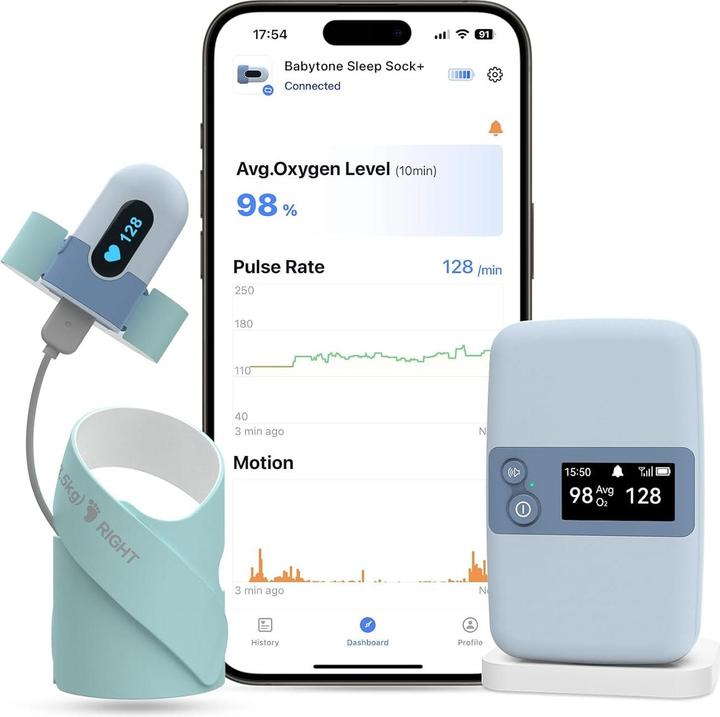 Produktbild ViatomTech BabyO2 - S2 Baby Oxygen Monitor