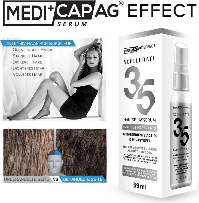 Produktbild Nutricap MediCap Haartonic Effect Xcellerate 35 (59 ml)