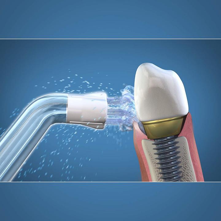 Actual product image Waterpik Whitening Water Flosser (Oral irrigator attachments)
