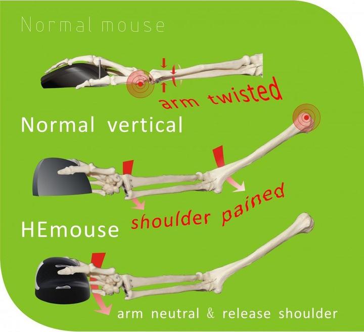 Produktbild Human Ergonomics Ergo (Kabelgebunden)
