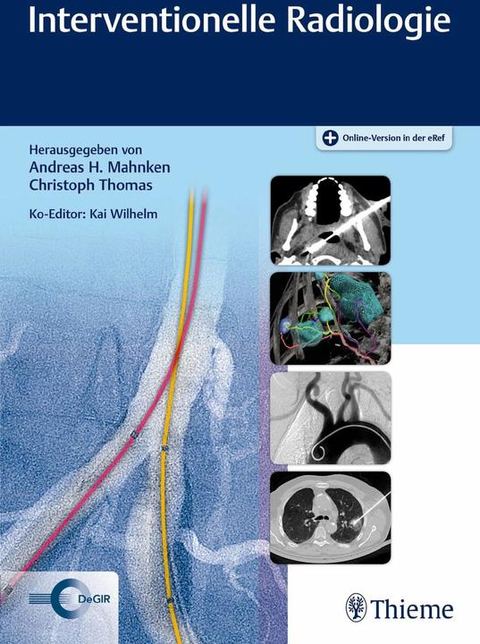 Image du produit Interventionelle Radiologie (Allemand, Christoph Thomas, Andreas H. Mahnken, 2019)
