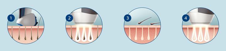 Actual product image Philips Lumea for Men