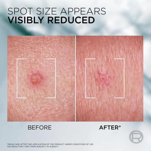 Actual product image L'Oréal Paris Men Expert Derma Control S.O.S Pimple Paste (45 ml)
