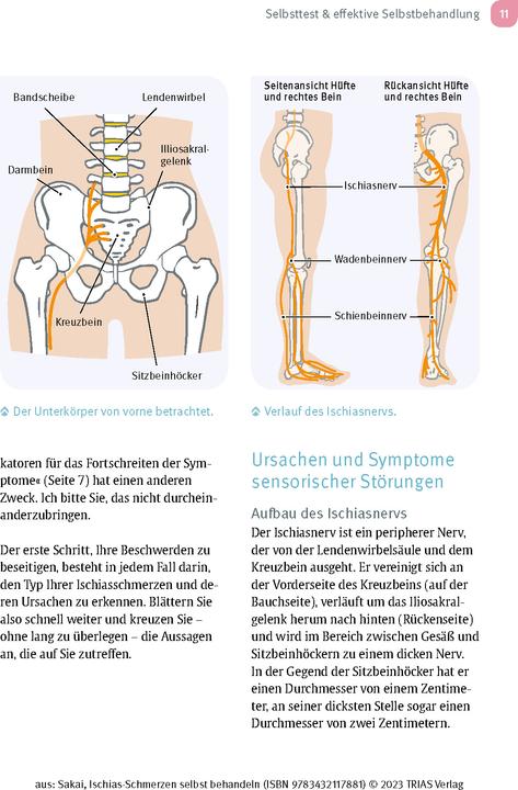 Produktbild Ischias-Schmerzen selbst behandeln (Deutsch, Shintaro Sakai, Birgit Quitterer, 2023)