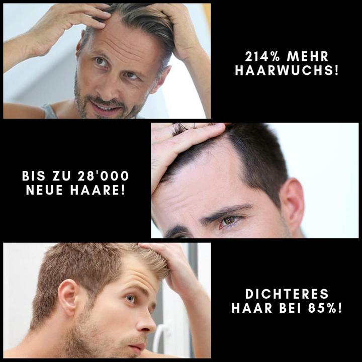 Produktbild Beneva Black Haarausfall Tonic (150 ml)