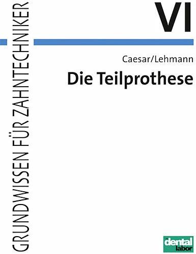 Produktbild Die Teilprothese (Deutsch, Hans H. Caesar, Klaus M. Lehmann, H Hans Caesar, 2007)