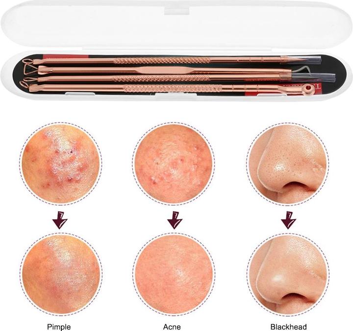 Image du produit JTI Traitement de l'acné et soins de la peau - Kit d'outils 2 en 1, 4 pièces