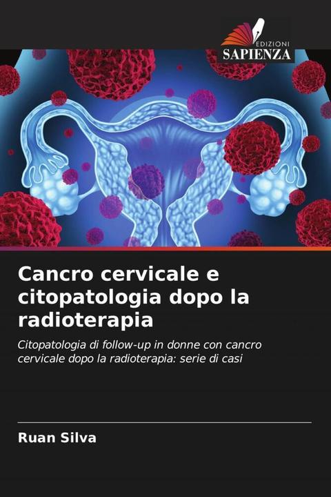 Image du produit Cancro cervicale e citopatologia dopo la radioterapia (Ruan Silva, 2024)
