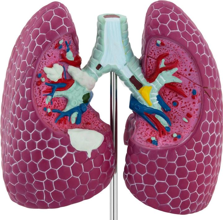 Produktbild Physa Lungenmodell 1:1 Organmodell menschliche Lunge anatomisches Modell Medizinmodell