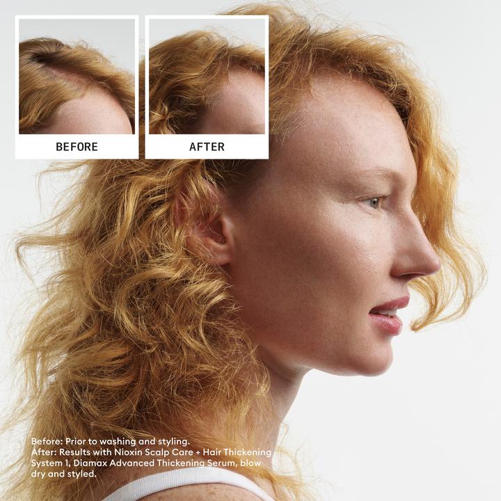 Produktbild Nioxin Scalp + Hair System 1 Treatment (100 ml)