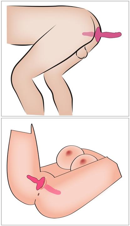 Productafbeelding Couples Choice 2in1 vibrator + buttplug