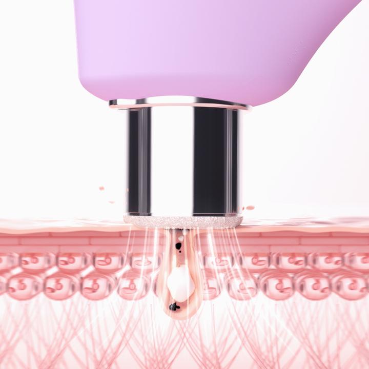Actual product image Foreo Kiwi Derma