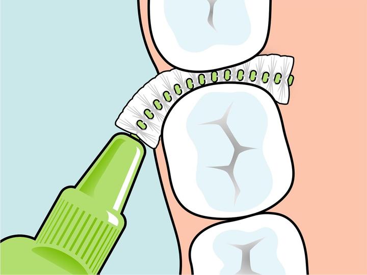 Produktbild TePe Interdentalbürsten Original Grün ISO 5 (8 x, 0.80 mm)