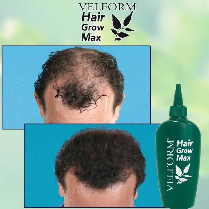 Produktbild Velform Hair Grow Max (200 ml)