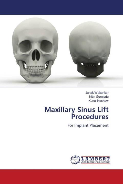 Immagine prodotto Maxillary Sinus Lift Procedures (Kunal Keshaw, Nitin Gorwade, Janak Wakankar, 2022)