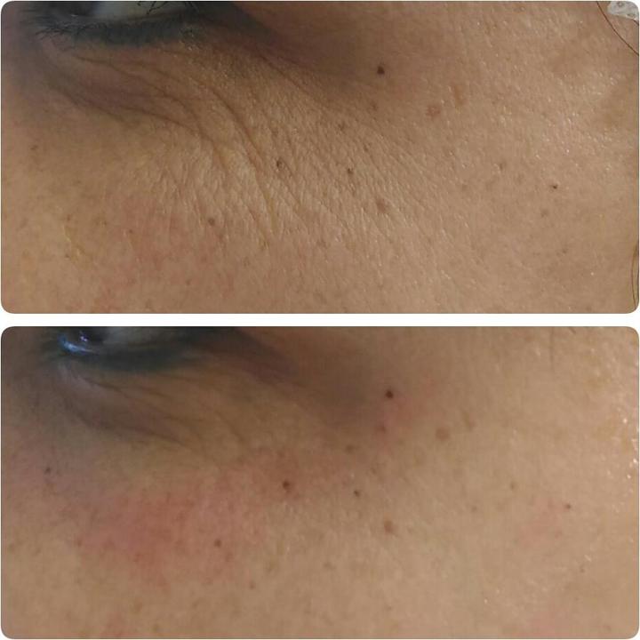 Produktbild Skinthings Skin Refiner Nano