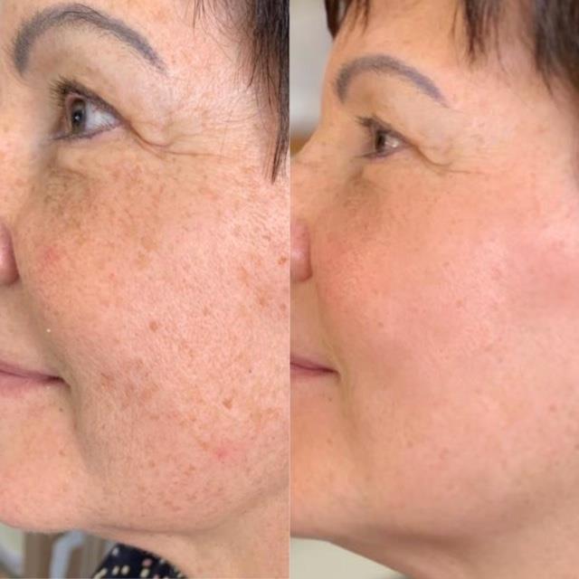 Produktbild Skinthings Skin Refiner Nano